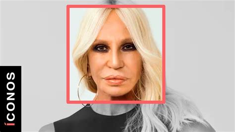 Los cambios en el rostro de Donatella: descubre qué le sucedió a 